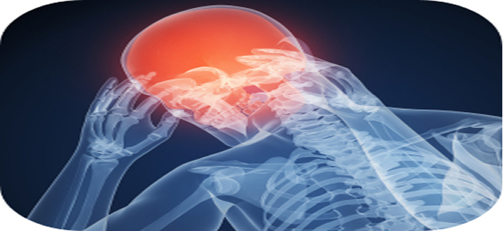 Treatment of Headache Pain