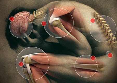 Trigger Point Pain - Trigger Point Therapy